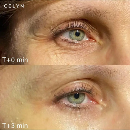 Gel Lifting Instantáneo